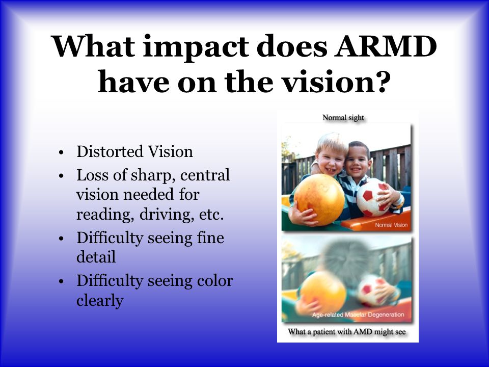 What impact does ARMD have on the vision