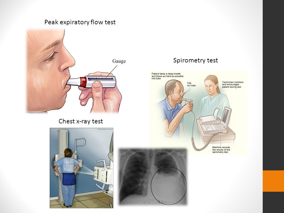 Peak expiratory flow test