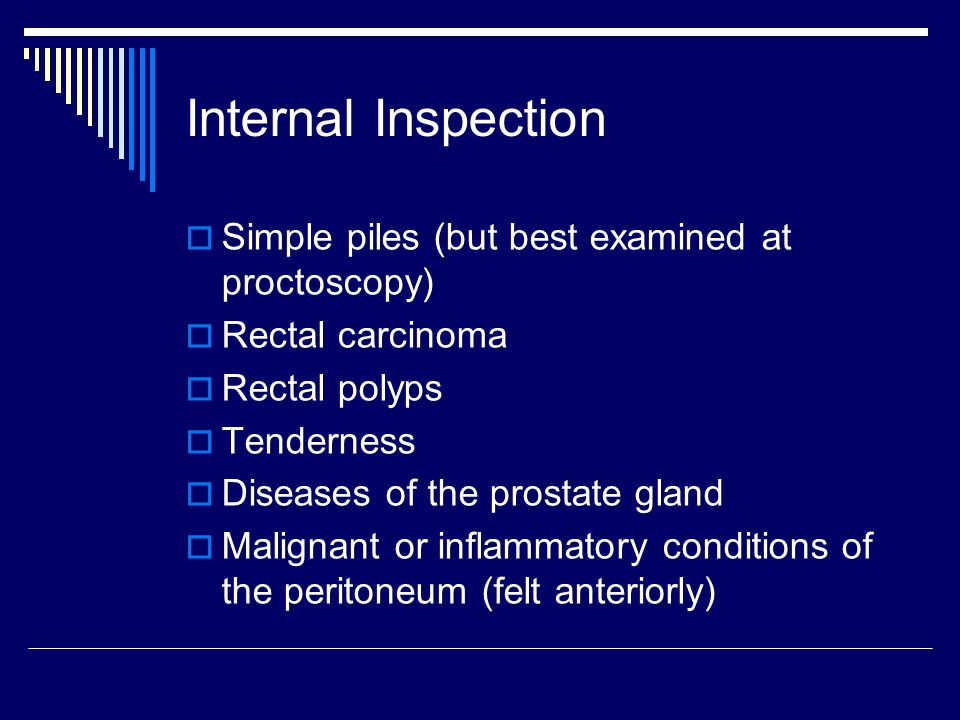 Internal Inspection Simple piles (but best examined at proctoscopy)