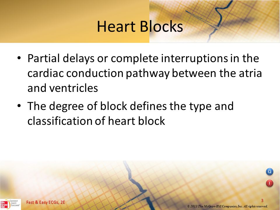 Heart Blocks Partial delays or complete interruptions in the cardiac conduction pathway between the atria and ventricles.
