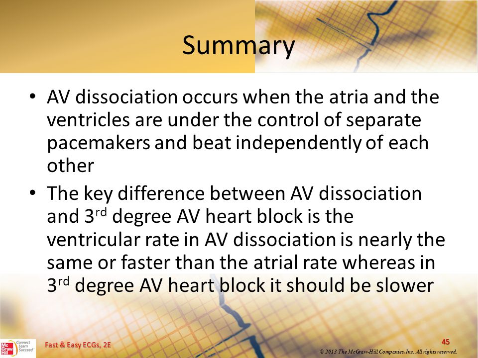 Summary AV dissociation occurs when the atria and the ventricles are under the control of separate pacemakers and beat independently of each other.