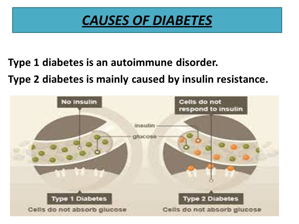 CAUSES OF DIABETES Type 1 diabetes is an autoimmune disorder.