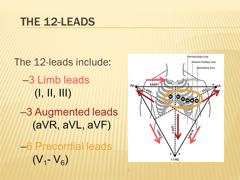 The 12-Leads The 12-leads include: 3 Limb leads (I, II, III)