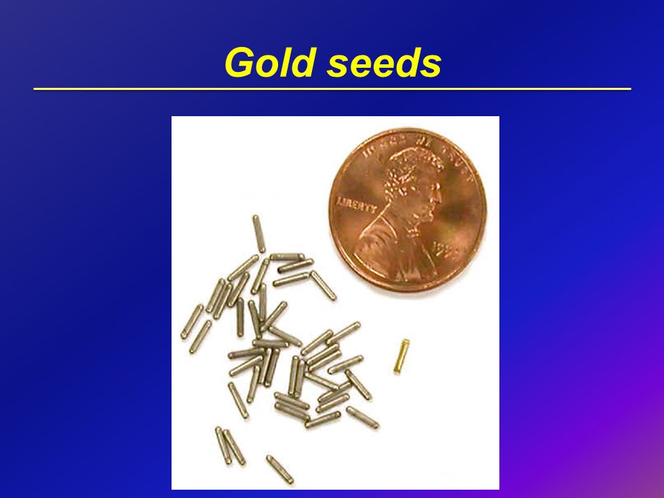 Gold seeds Gold – doesn’t react with body; dense so can be seen on treatment. Put in with transrectal ultrasound (like the biopsy in reverse)