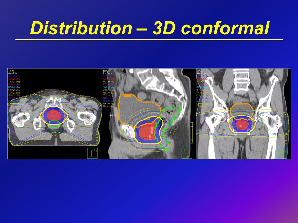 Distribution – 3D conformal