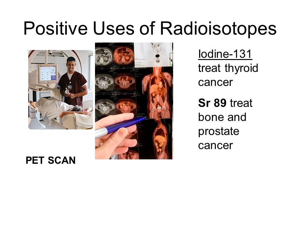 Positive Uses of Radioisotopes