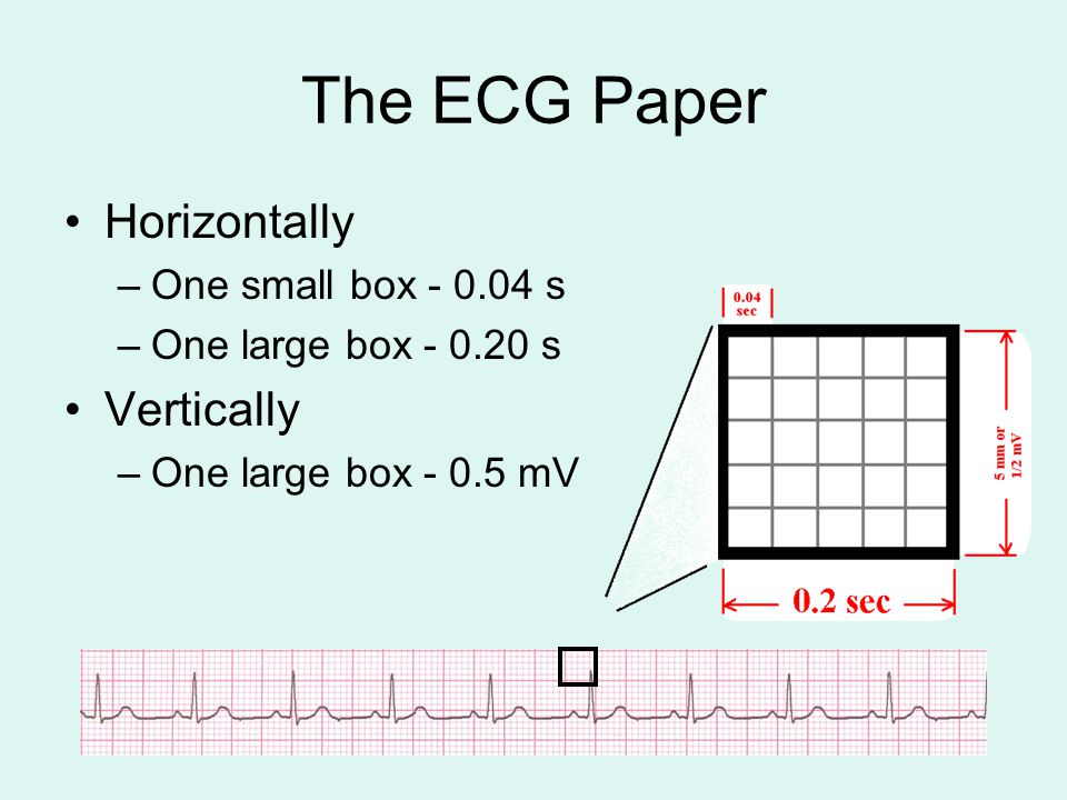 The ECG Paper Horizontally Vertically One small box s