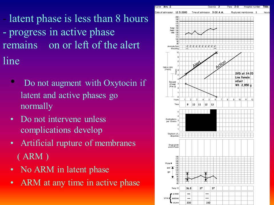 Do not augment with Oxytocin if latent and active phases go normally
