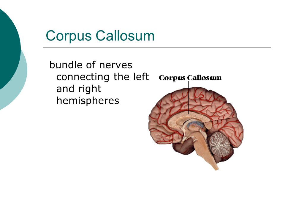 Corpus Callosum bundle of nerves connecting the left and right hemispheres