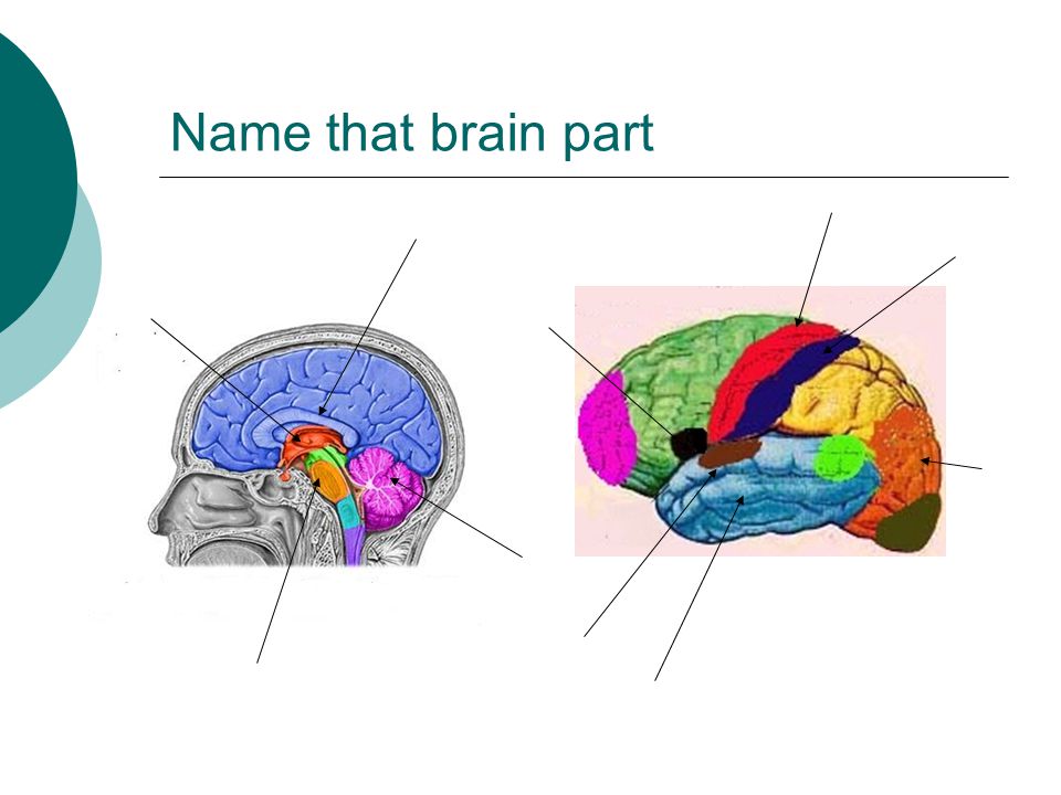 Name that brain part