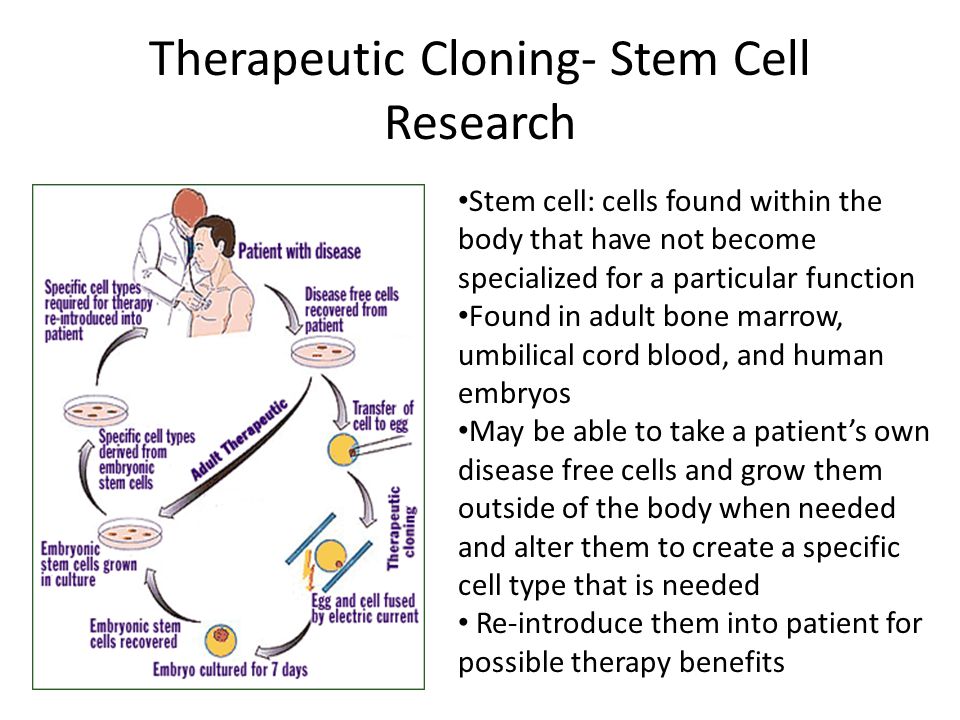Therapeutic Cloning- Stem Cell Research