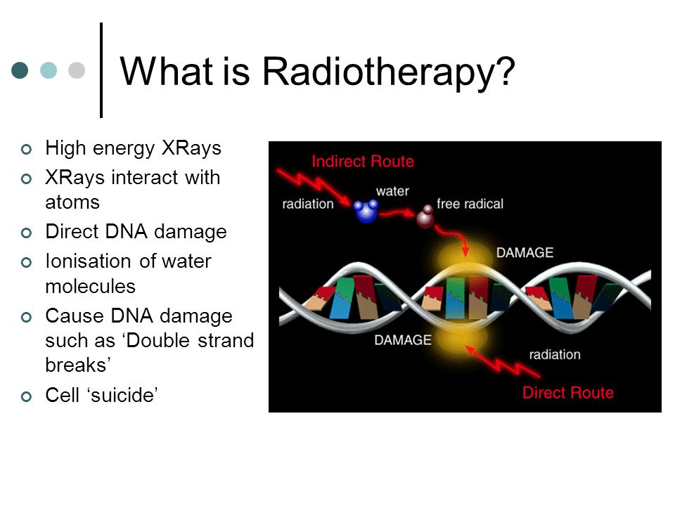 What is Radiotherapy High energy XRays XRays interact with atoms