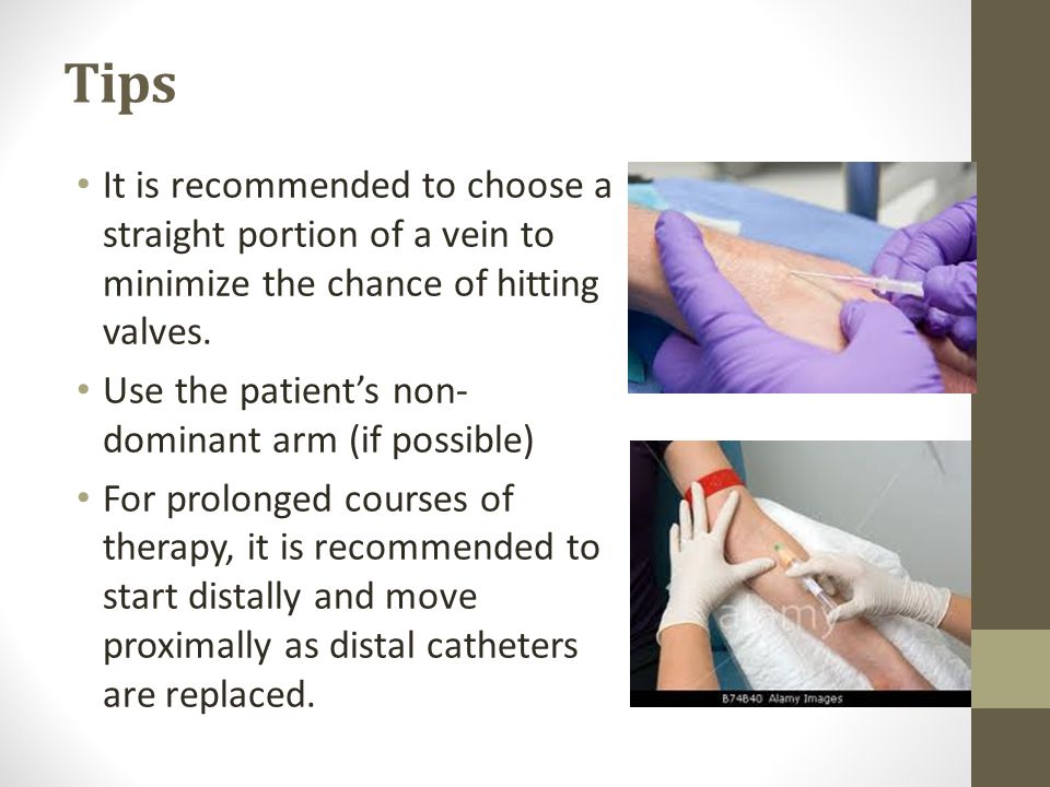 Tips It is recommended to choose a straight portion of a vein to minimize the chance of hitting valves.