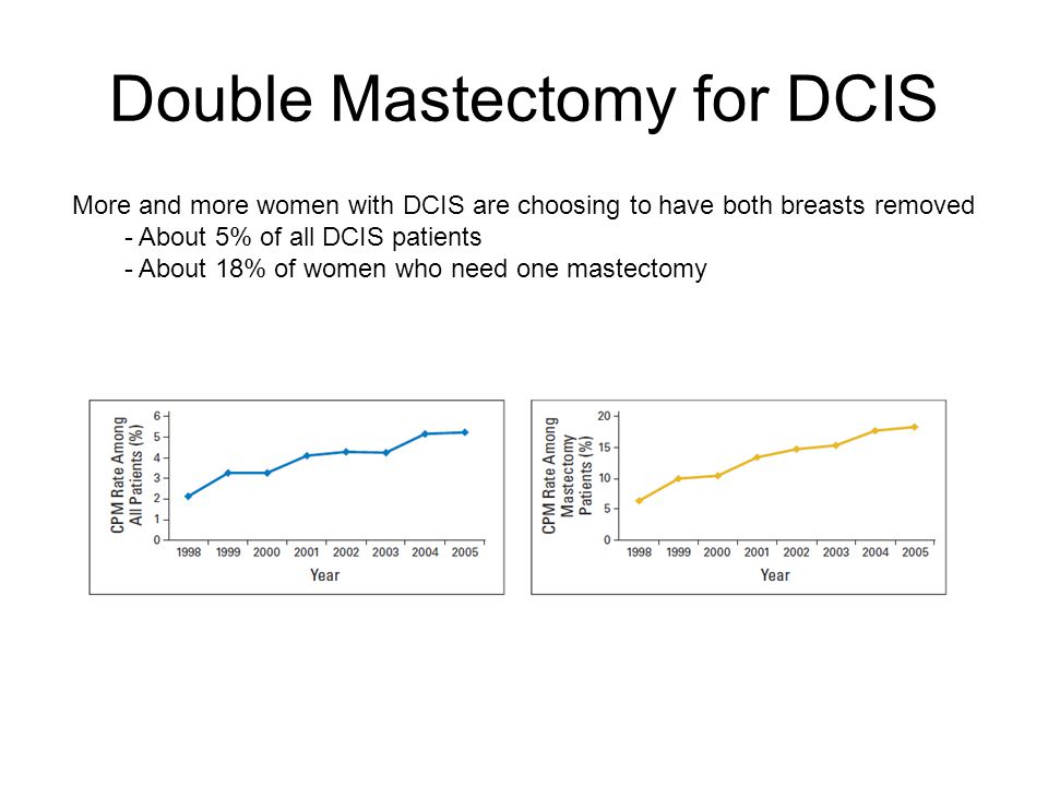 Double Mastectomy for DCIS