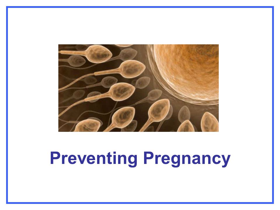 Preventing Pregnancy