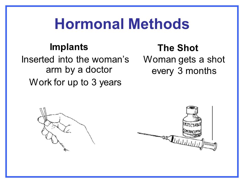 Hormonal Methods Implants Inserted into the woman’s arm by a doctor