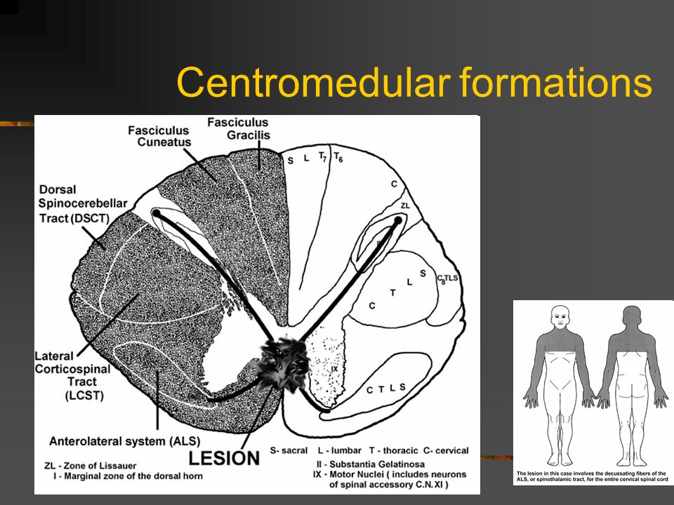 Centromedular formations