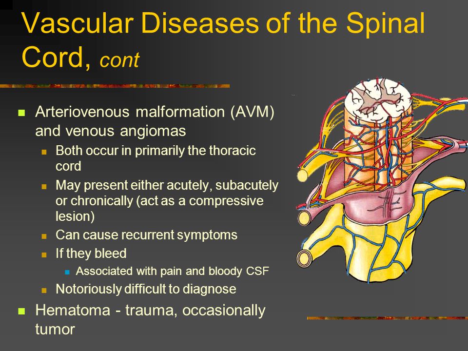 Vascular Diseases of the Spinal Cord, cont
