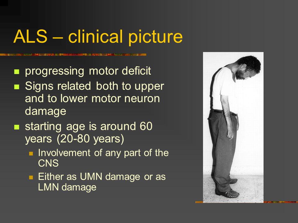 ALS – clinical picture progressing motor deficit