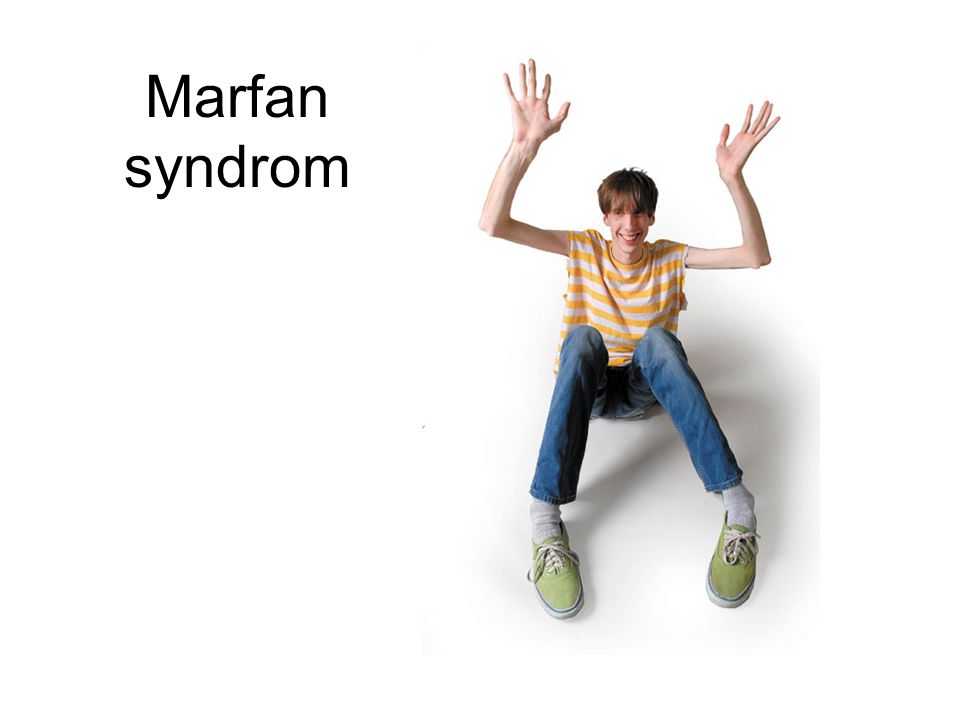 Marfan syndrom