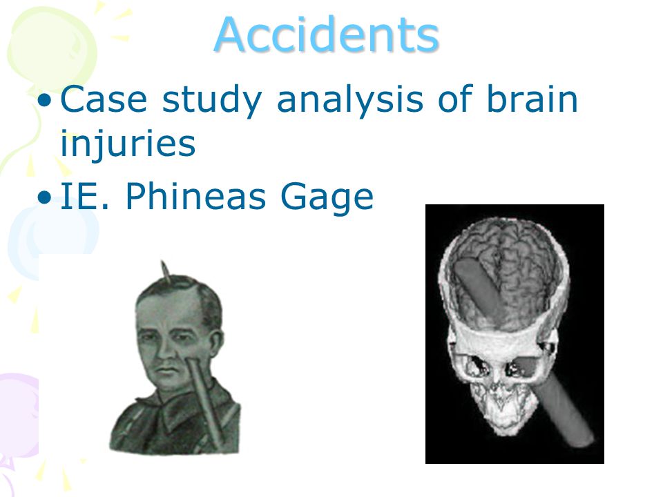 Accidents Case study analysis of brain injuries IE. Phineas Gage