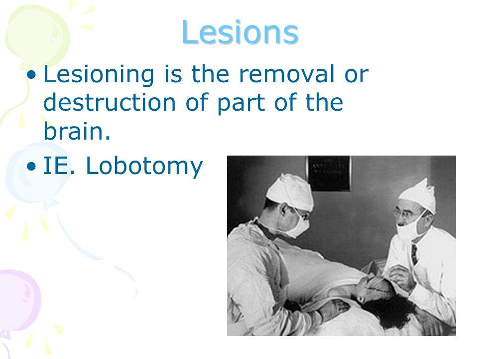 Lesions Lesioning is the removal or destruction of part of the brain.