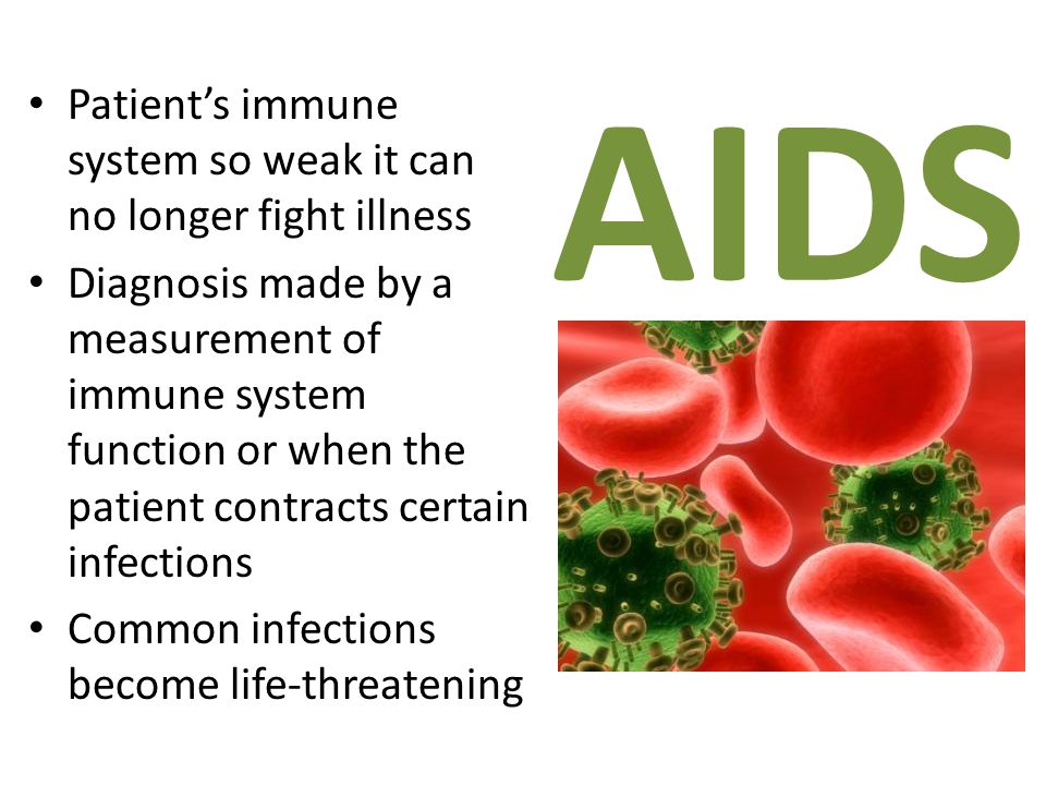 AIDS Patient’s immune system so weak it can no longer fight illness