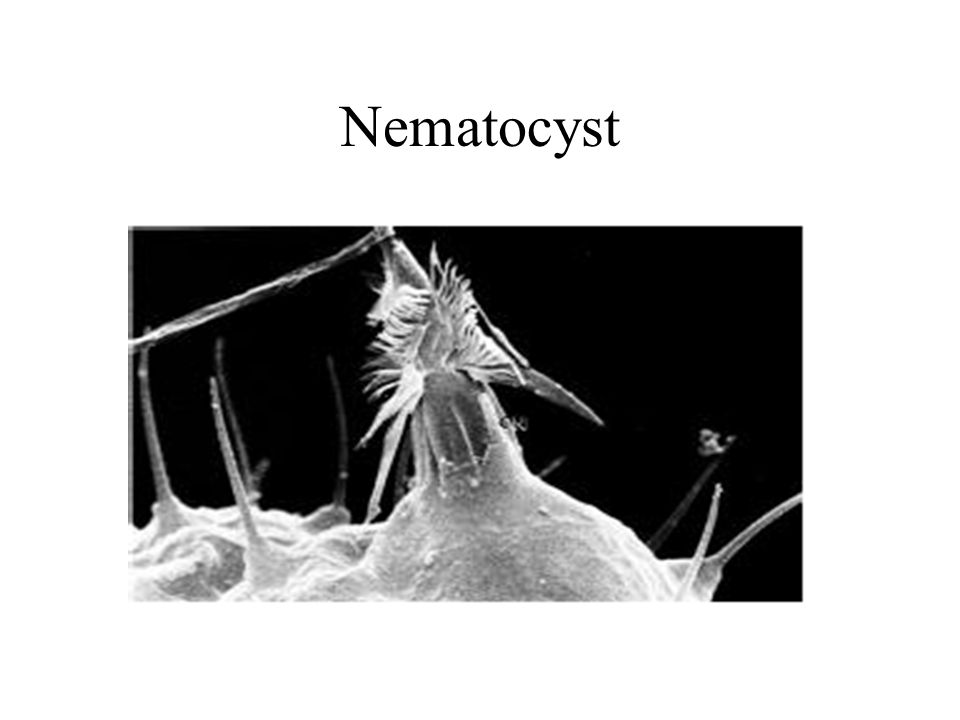 Nematocyst