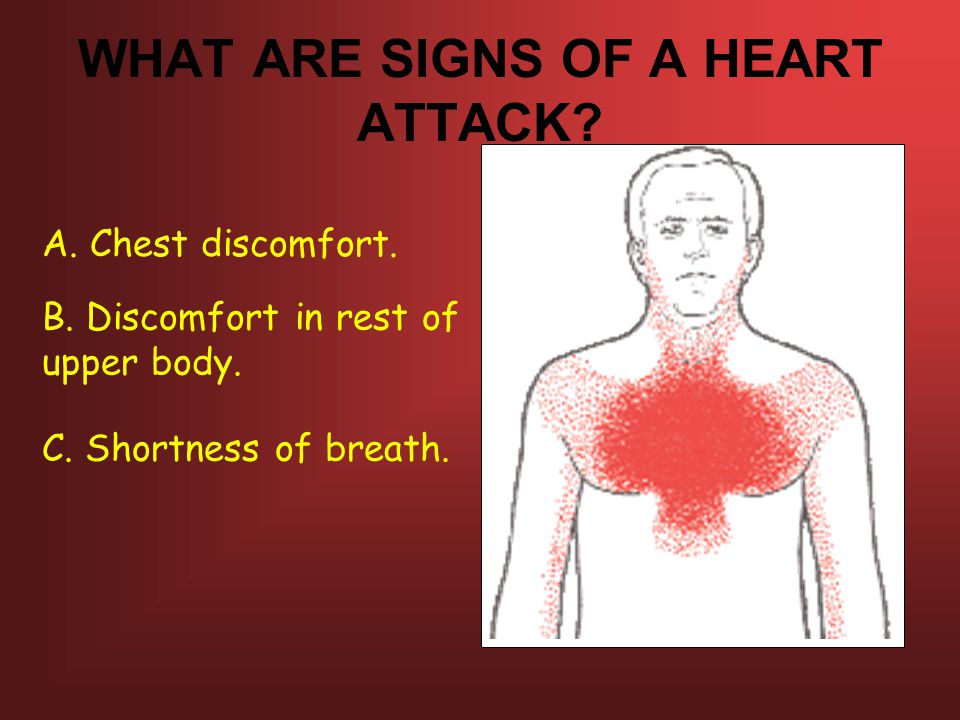 WHAT ARE SIGNS OF A HEART ATTACK