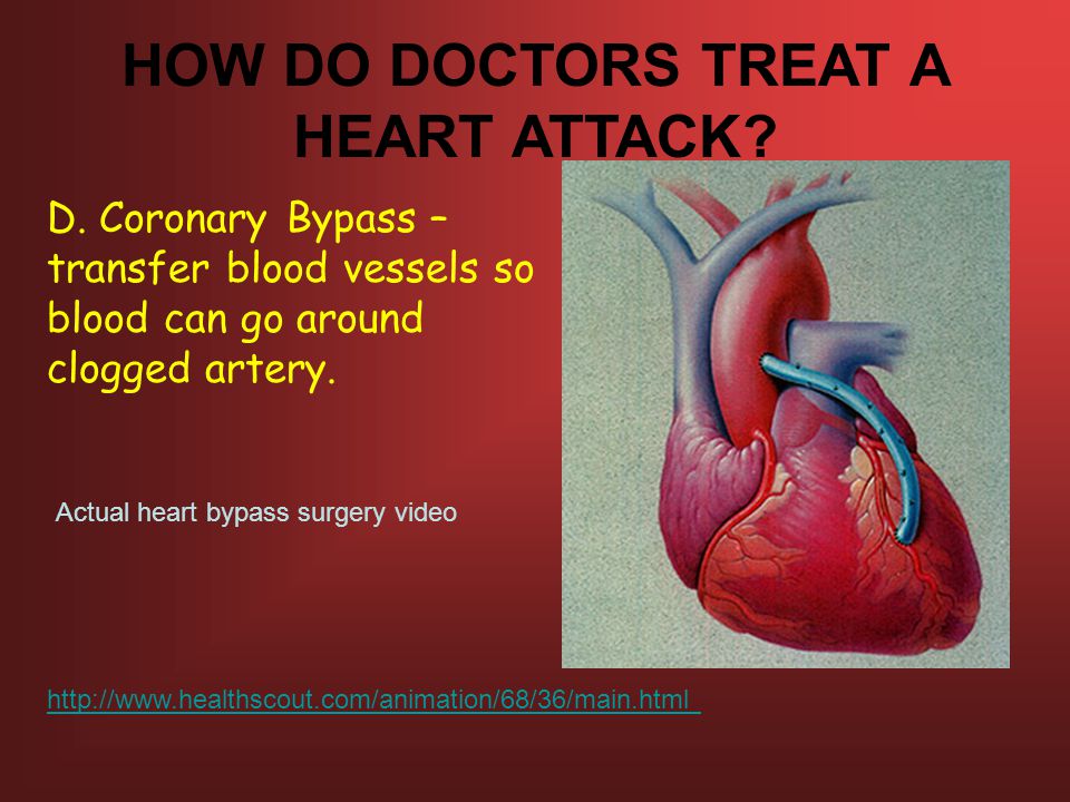 HOW DO DOCTORS TREAT A HEART ATTACK