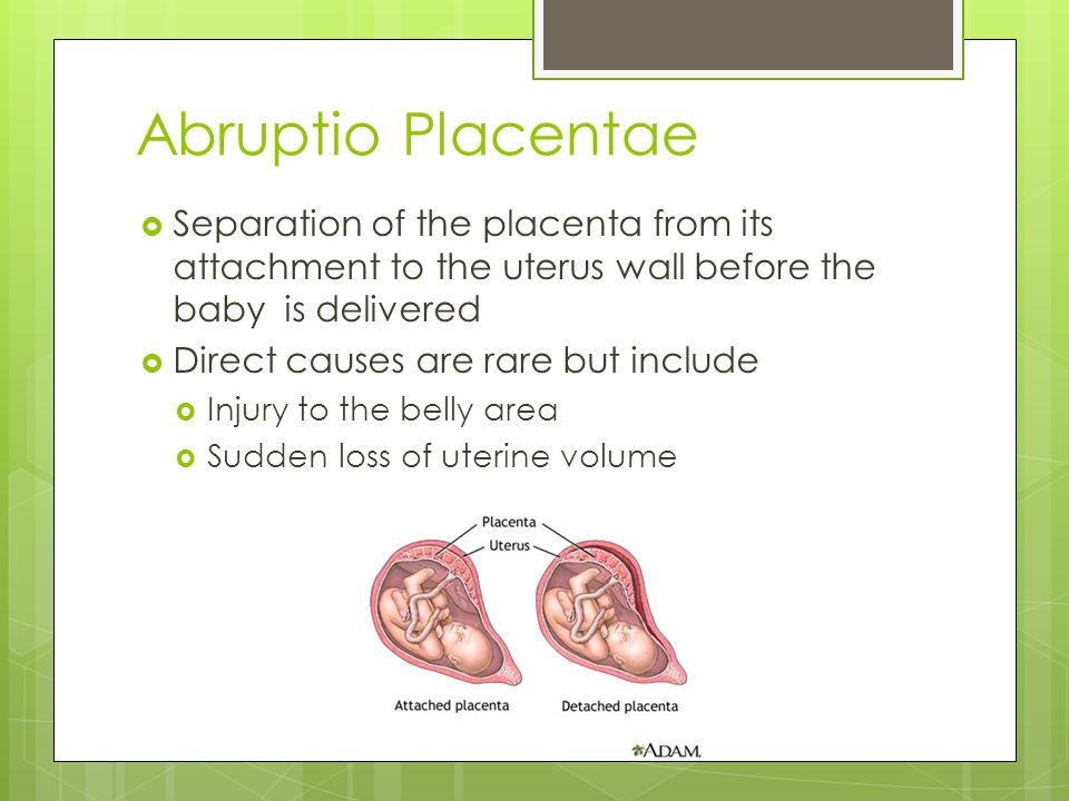 Abruptio Placentae Separation of the placenta from its attachment to the uterus wall before the baby is delivered.