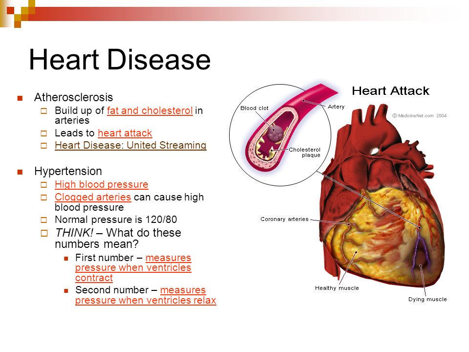 Heart Disease Atherosclerosis Hypertension