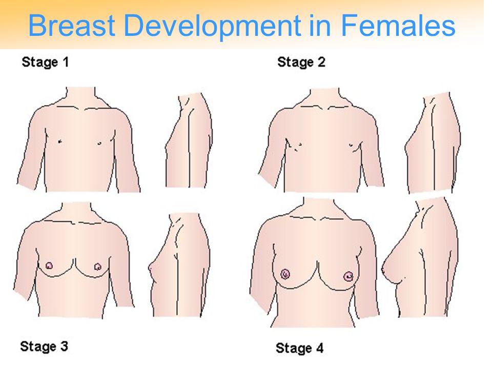 Pubescent breast development gallery