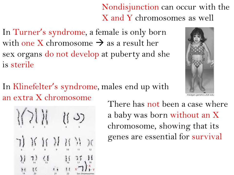 Nondisjunction can occur with the X and Y chromosomes as well