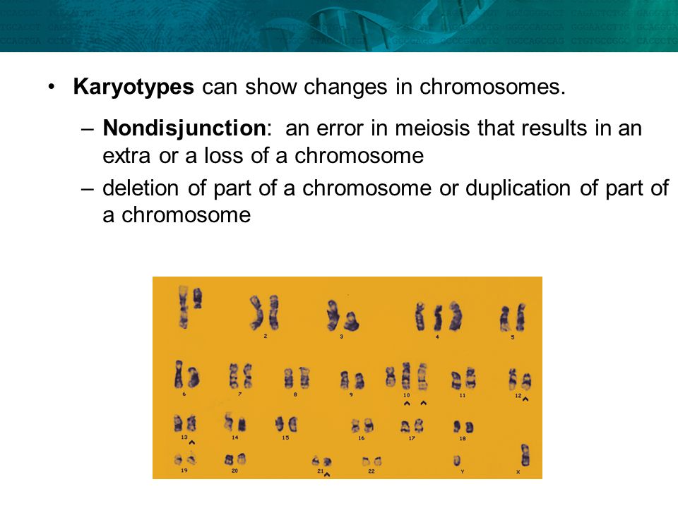 Karyotypes can show changes in chromosomes.