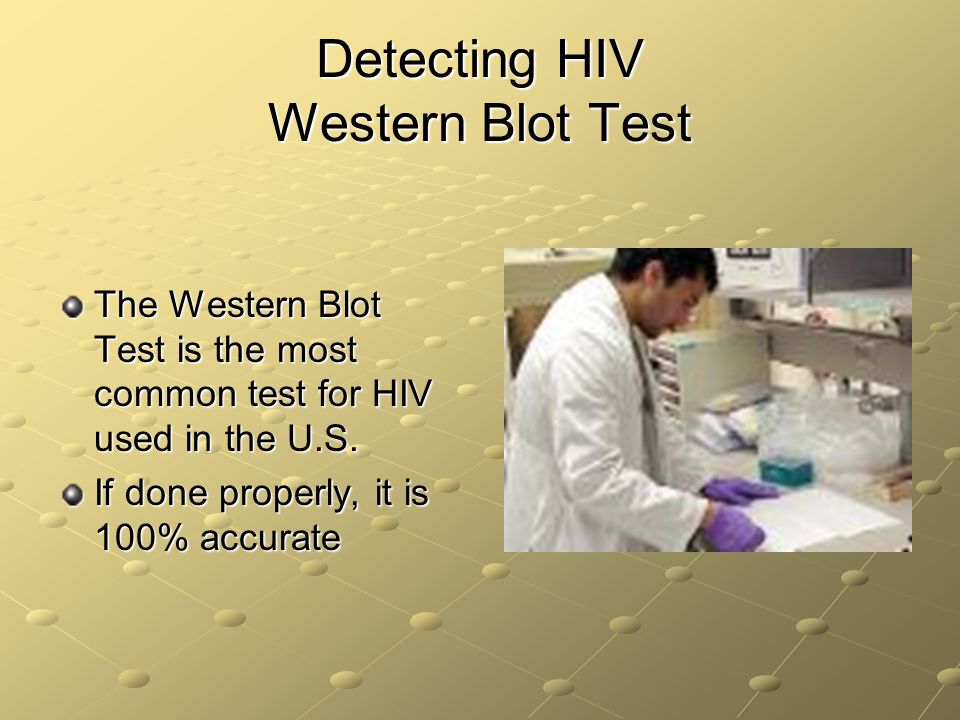 Detecting HIV Western Blot Test