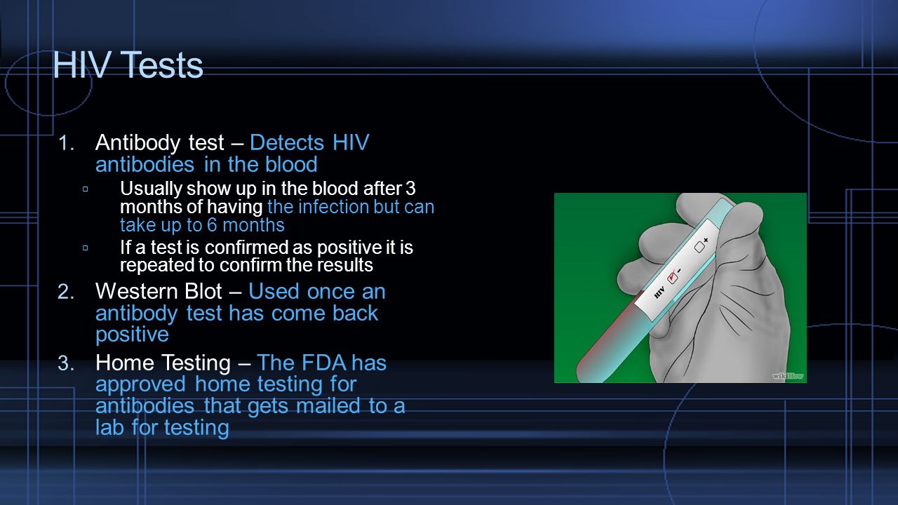HIV Tests Antibody test – Detects HIV antibodies in the blood