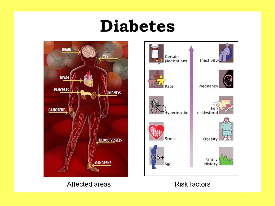 Diabetes Affected areas Risk factors