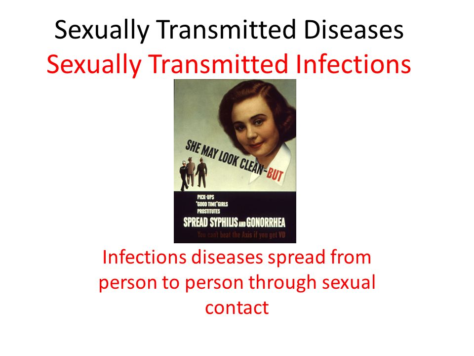 prostitute sexually transmitted disease