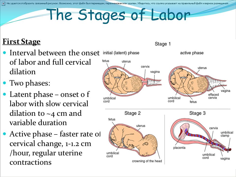 The Stages of Labor First Stage