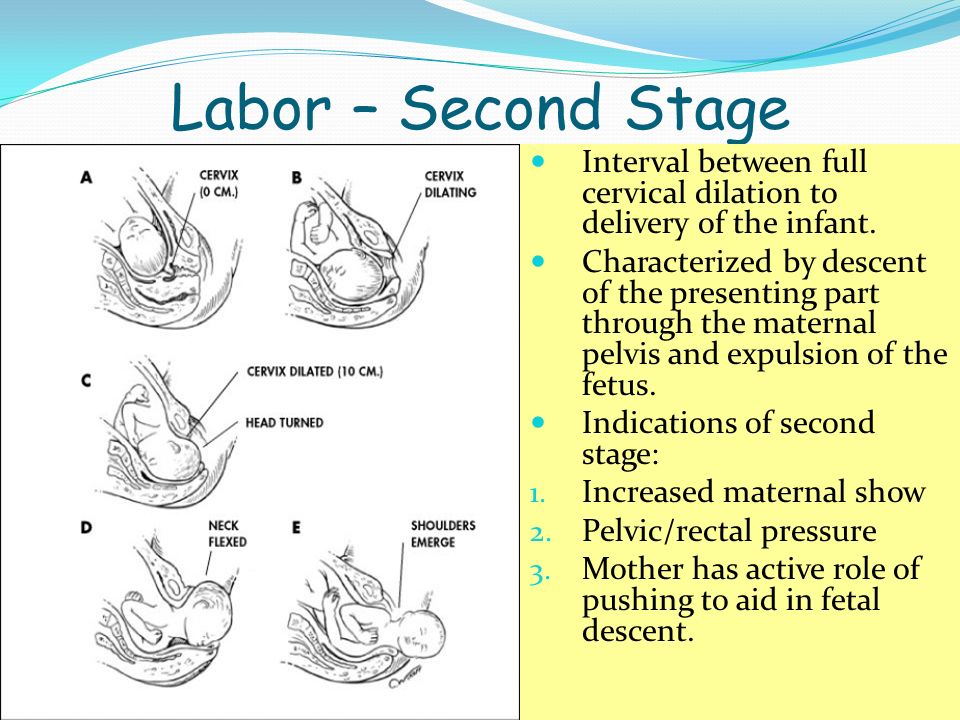 Labor – Second Stage Interval between full cervical dilation to delivery of the infant.