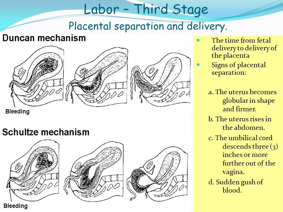 Labor – Third Stage Placental separation and delivery.