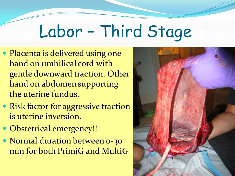 Labor – Third Stage
