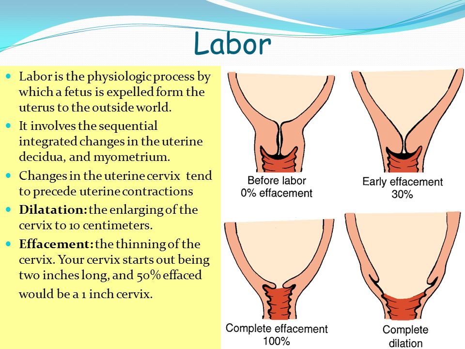 Labor Labor is the physiologic process by which a fetus is expelled form the uterus to the outside world.