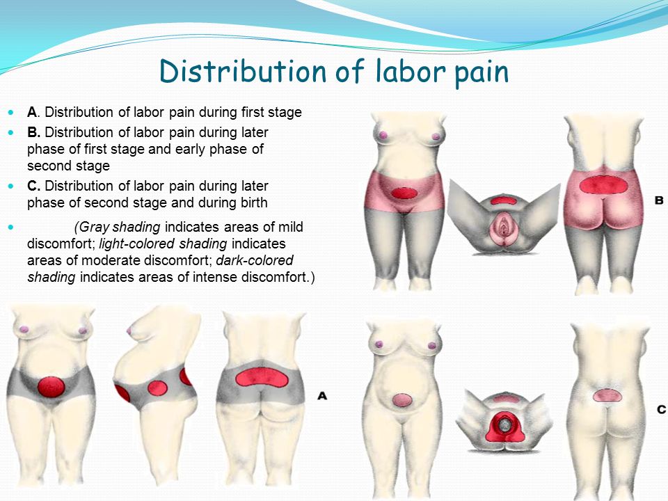 Distribution of labor pain