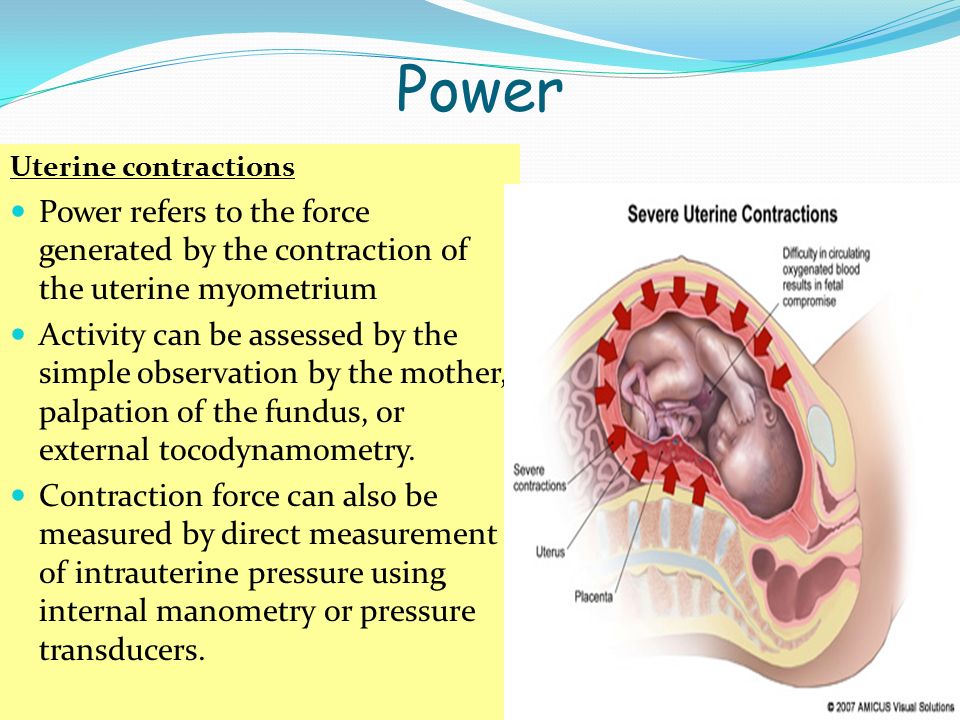 Power Uterine contractions. Power refers to the force generated by the contraction of the uterine myometrium.