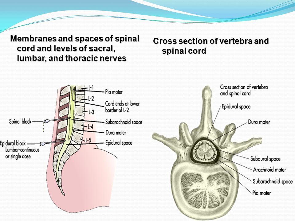 Membranes and spaces of spinal cord and levels of sacral, lumbar, and thoracic nerves