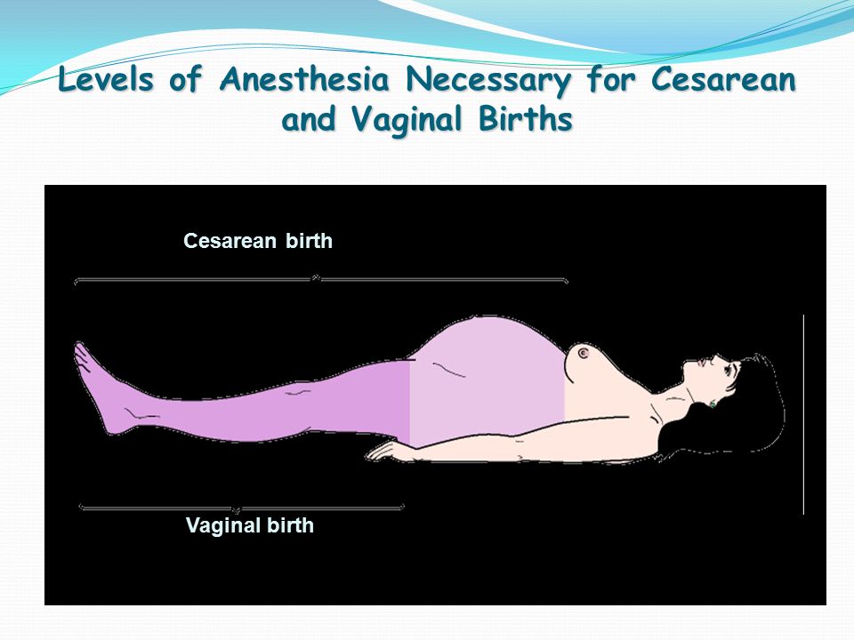 Levels of Anesthesia Necessary for Cesarean and Vaginal Births