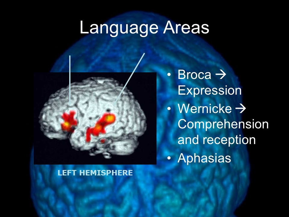 Language Areas Broca  Expression
