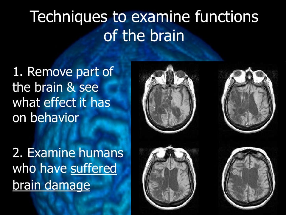 Techniques to examine functions of the brain